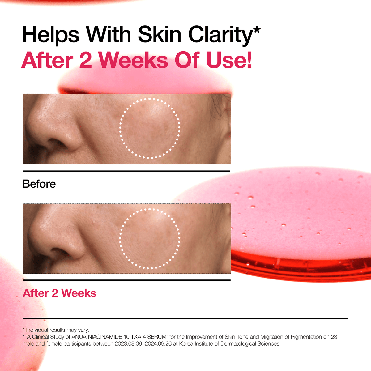 Comparación del antes y después del uso del serum Anua Niacinamide 10 + TXA 4, mostrando mejora en la claridad y tono de la piel tras dos semanas.