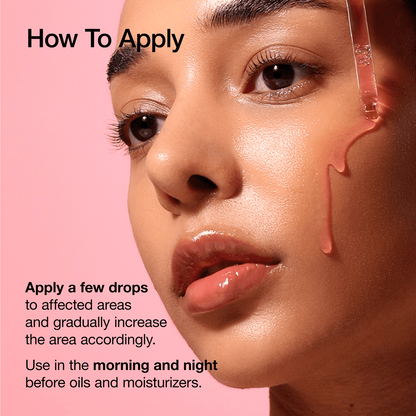 Primer plano de una mujer aplicando el serum Anua Niacinamide 10 + TXA 4 con pipeta, gotas rosadas sobre la mejilla, fondo rosado y piel luminosa.