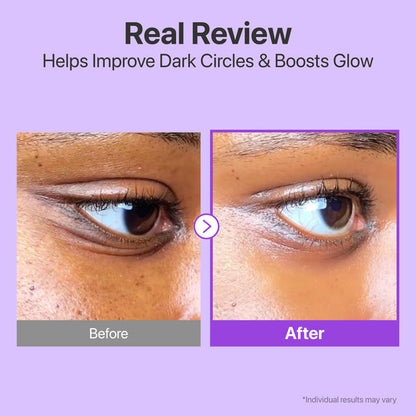Crema de Ojos No.9 - Efecto Relleno con Retinol y NAD+